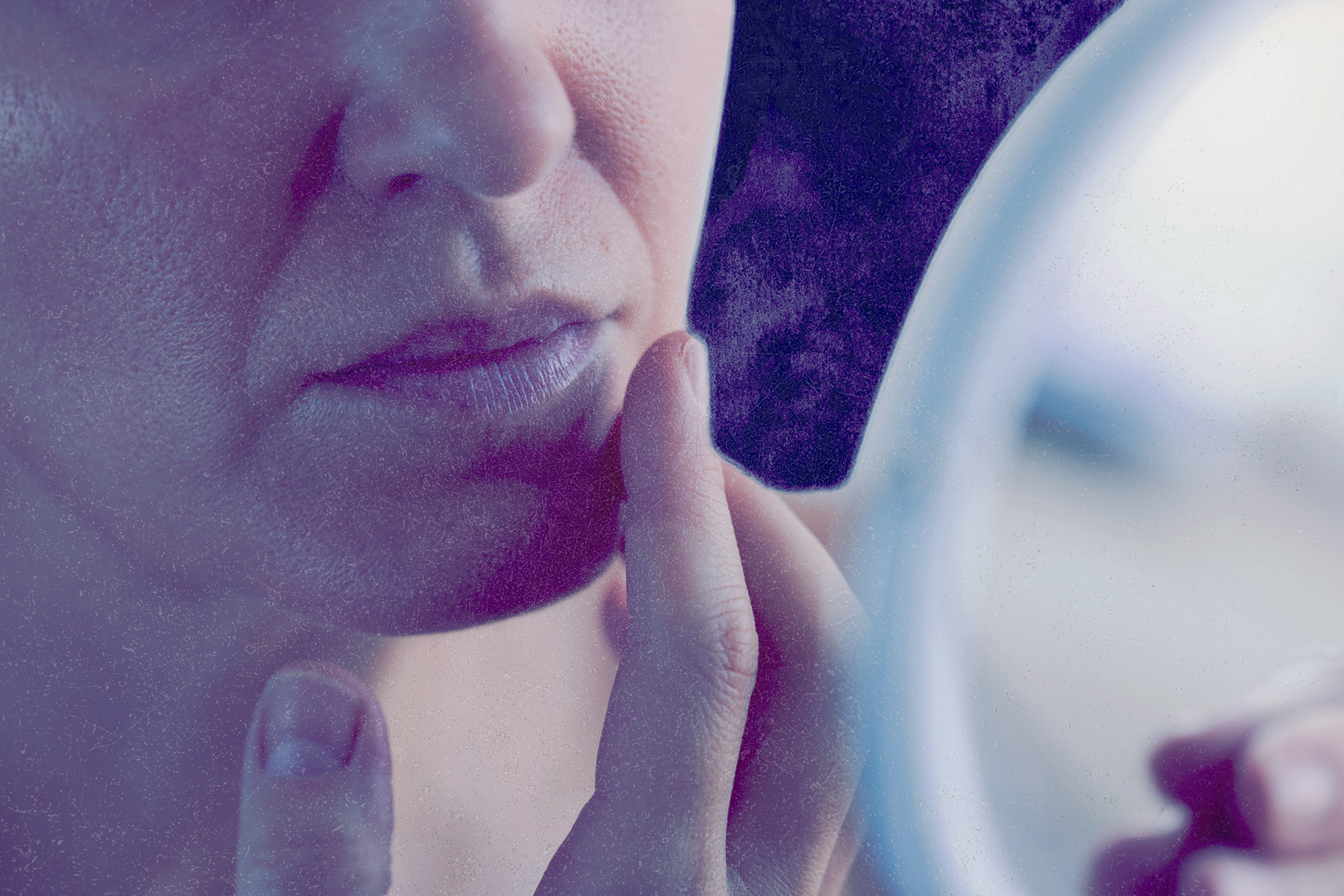 Why Your Dermatologist Is Upselling You on Pricey Procedures You Don't Need