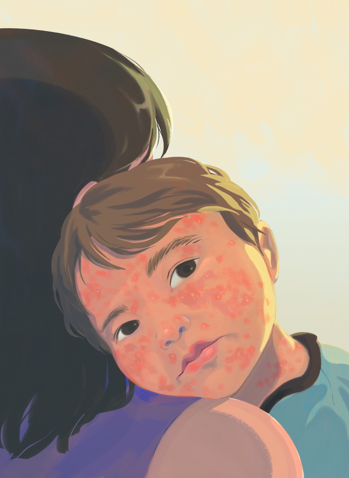 An illustration of a young boy, his face covered in measles, resting his head on his mother's shoulder